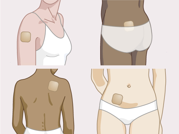 Contraceptive patch